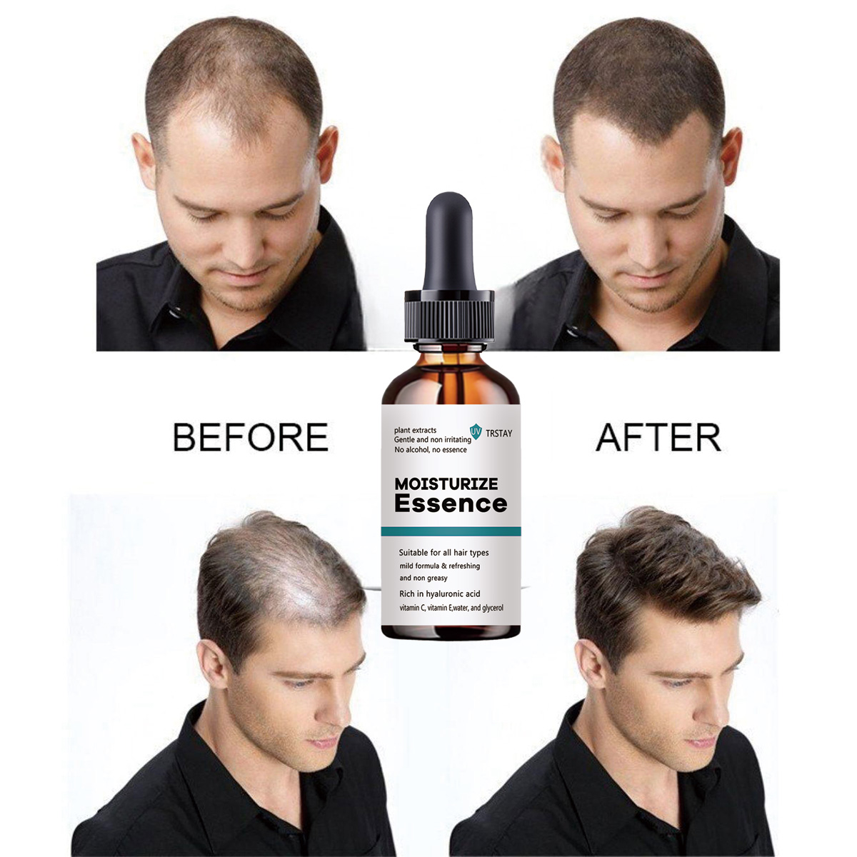 Hair Care Ordinary - 2022 New Hair Growth Essence Promotes