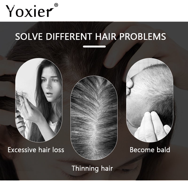 Intensive Growth Serum Prevent - Hair Care Serum 评论和价格