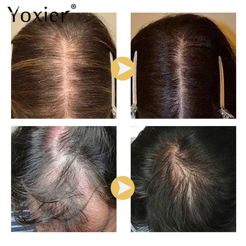 Intensive Growth Serum Prevent - Hair Care Serum 评论和价格