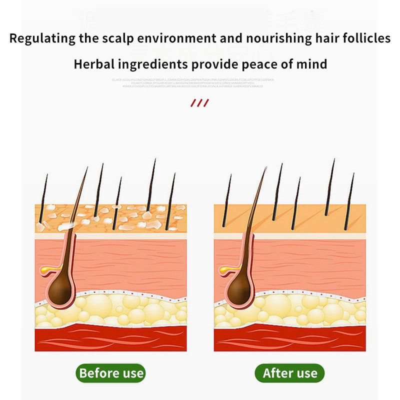 Sophora Flavescens Hair Follic - Hair Care Oil 评论和价格