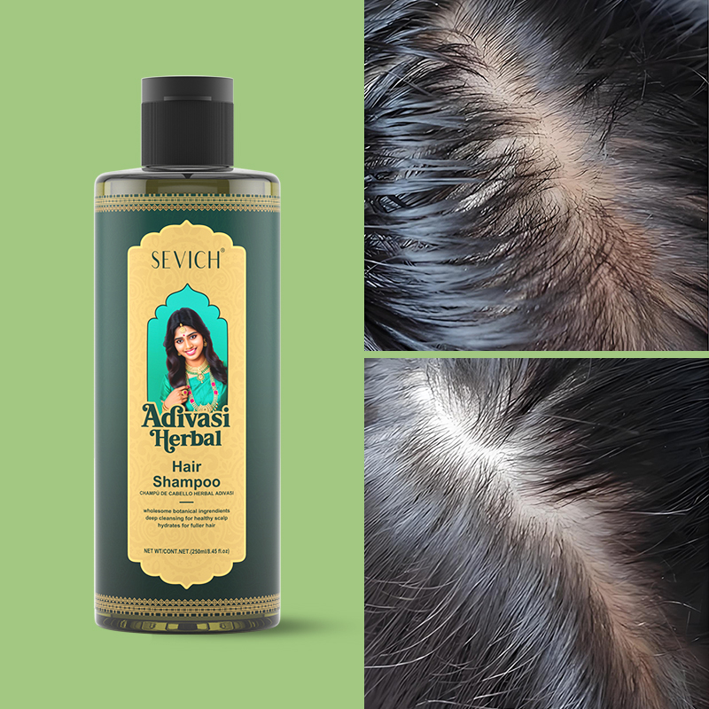 Hair Growth Oil Set Rosemary H - Hair Care India 评论和价格